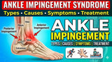 Ankle Impingement Syndrome: Types, Causes, Symptoms, Diagnosis, and Treatment - Carevion