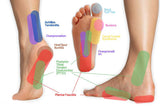 Sore Foot Arch from Running: Causes, Treatment, and What Runners Should Do - Carevion